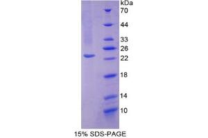 SDS-PAGE analysis of Mouse SOD2 Protein. (SOD2 Protein)