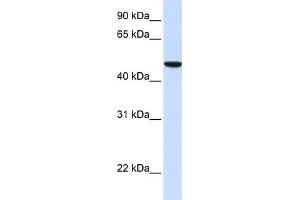 WB Suggested Anti-SLC2A6 Antibody Titration:  0. (SLC2A6 antibody  (N-Term))