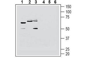 Western blot analysis of human Jurkat T-cell leukemia cell line lysate (lanes 1 and 4), human U-87 MG glioblastoma cell line lysate (lanes 2 and 5) and human SH-SY5Y neuroblastoma cell line lysate (lanes 3 and 6): - 1-3. (HRH1 antibody  (2nd Extracellular Loop))