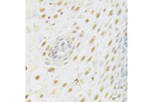 Immunohistochemistry of paraffin-embedded human esophagus using HDAC3 Antibody (ABIN5971166) at dilution of 1/100 (40x lens). (HDAC3 antibody)