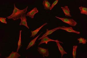 IF analysis of BAT3/BAG6 using anti-BAT3/BAG6 antibody (ABIN6719601) and anti-Beta Tubulin antibody (ABIN7602743).