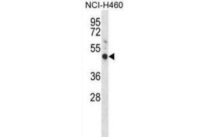 Western Blotting (WB) image for anti-G Protein-Coupled Estrogen Receptor 1 (GPER) antibody (ABIN2998385) (GPER antibody)