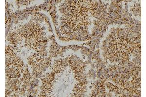 ABIN6273478 at 1/100 staining  testis tissue by IHC-P. (CYLC2 antibody  (C-Term))