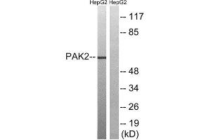 Western Blotting (WB) image for anti-P21-Activated Kinase 2 (PAK2) (Ser192) antibody (ABIN1848249) (PAK2 antibody  (Ser192))