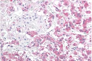 ABIN184852 (10µg/ml) staining of paraffin embedded Human Adrenal Gland. (HSPB8 antibody  (C-Term))
