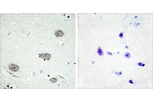 P-peptide - +Immunohistochemistry analysis of paraffin-embedded human brain tissue using CSFR (Phospho-Tyr809) antibody. (CSF1R antibody  (pTyr809))