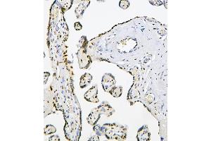 IHC analysis of PHF21A using anti-PHF21A antibody (ABIN6719353). (PHF21A antibody  (AA 1-97))