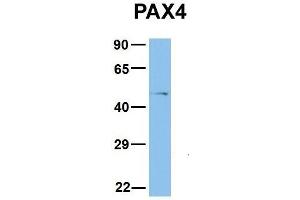 Host:  Rabbit  Target Name:  PAX4  Sample Type:  COLO205  Antibody Dilution:  1. (PAX4 antibody  (Middle Region))