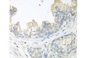 Immunohistochemistry of paraffin-embedded Human prostate using CUL3 Polyclonal Antibody at dilution of 1:100 (40x lens). (Cullin 3 antibody)