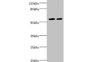 Western blot All lanes: ALDH4A1 antibody at 13 μg/mL Lane 1: K562 whole cell lysate Lane 2: 293T whole cell lysate Secondary Goat polyclonal to rabbit IgG at 1/10000 dilution Predicted band size: 62, 56, 57 kDa Observed band size: 62 kDa (ALDH4A1 antibody  (AA 354-563))
