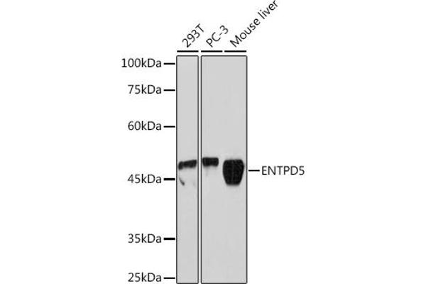 ENTPD5 antibody