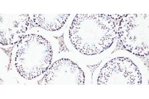 Immunohistochemistry of paraffin-embedded Mouse testis using Bcl9 Polyclonal Antibody at dilution of 1:100 (20x lens). (BCL9 antibody)