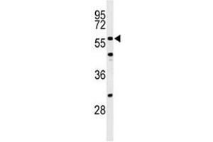 Western blot analysis of CDC25C antibody and NIH3T3 lysate. (CDC25C antibody  (AA 114-142))