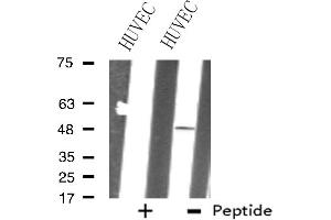 Western blot analysis of extracts from HUVEC cells, using ZNF24 antibody.
