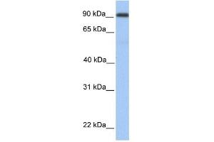 MMEL1 antibody used at 1 ug/ml to detect target protein. (MMEL1 antibody  (Middle Region))