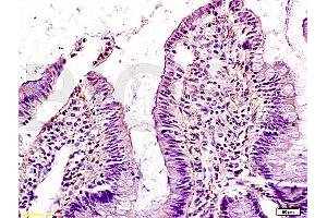 Formalin-fixed and paraffin embedded rat intestine tissue labeled with Anti-GM-CSF Polyclonal Antibody (ABIN730723), Unconjugated at 1:200, followed by conjugation to the secondary antibody and DAB staining (GM-CSF antibody  (AA 71-141))