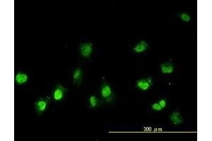Image no. 2 for anti-NIMA (Never In Mitosis Gene A)-Related Kinase 11 (NEK11) (AA 1-483) antibody (ABIN599307) (NEK11 antibody  (AA 1-483))