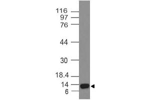 Image no. 1 for anti-Activin A Receptor Type II-Like 1 (ACVRL1) (AA 310-503) antibody (ABIN5027019) (ACVRL1 antibody  (AA 310-503))