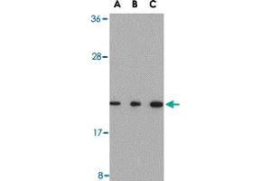 Western blot analysis of TMED10 in Raji cell lysate with TMED10 polyclonal antibody  at (A) 0. (TMED10 antibody  (C-Term))