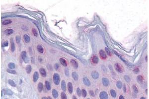 Human Skin: Formalin-Fixed, Paraffin-Embedded (FFPE) (p53 antibody  (N-Term))
