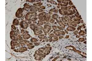 Immunoperoxidase of monoclonal antibody to CACNA2D2 on formalin-fixed paraffin-embedded human pancreas. (CACNA2D2 antibody  (AA 65-162))