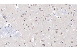 Detection of LCAT in Human Cerebrum Tissue using Monoclonal Antibody to Lecithin Cholesterol Acyltransferase (LCAT) (LCAT antibody  (AA 290-433))