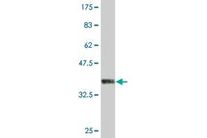 Western Blot detection against Immunogen (35. (IARS antibody  (AA 1172-1262))