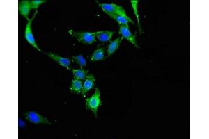 Immunofluorescent analysis of Hela cells using ABIN7150995 at dilution of 1:100 and Alexa Fluor 488-congugated AffiniPure Goat Anti-Rabbit IgG(H+L) (CBL antibody  (AA 548-847))