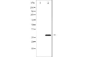 Western blot analysis of 14-3-3 zeta expression in Forskolin treated 293 whole cell lysates,The lane on the left is treated with the antigen-specific peptide. (14-3-3 zeta antibody  (Internal Region))