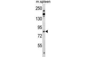 Western Blotting (WB) image for anti-TCDD-Inducible Poly(ADP-Ribose) Polymerase (Tiparp) antibody (ABIN3003615) (Tiparp antibody)