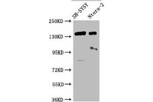 Western Blot Positive WB detected in: SH-SY5Y whole cell lysate, Ntera-2 whole cell lysate All lanes: ROBO2 antibody at 1:2000 Secondary Goat polyclonal to rabbit IgG at 1/50000 dilution Predicted band size: 131, 152, 154 kDa Observed band size: 152 kDa (ROBO2 antibody  (AA 450-660))