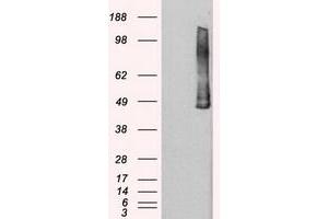 Image no. 2 for anti-Polo-Like Kinase 1 (PLK1) antibody (ABIN1500282) (PLK1 antibody)