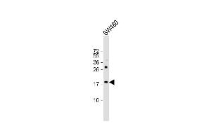 Western Blotting (WB) image for anti-KiSS-1 Metastasis-Suppressor (KISS1) (AA 20-52) antibody (ABIN6243764)