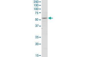 THRA polyclonal antibody (A01). (THRA antibody  (AA 87-178))