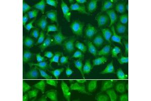 Immunofluorescence analysis of A549 cells using XRCC2 Polyclonal Antibody (XRCC2 antibody)