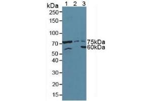 Western blot analysis of (1) Mouse Pancreas Tissue, (2) Human HeLa cells and (3) Human 293T Cells. (ATF6 antibody  (AA 423-646))
