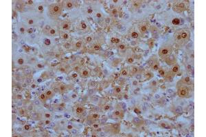 IHC image of ABIN7180448 diluted at 1:100 and staining in paraffin-embedded human liver tissue performed on a Leica BondTM system. (Liver Arginase antibody)