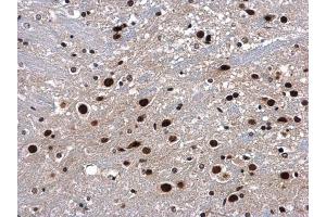 IHC-P Image p54/nrb antibody detects p54/nrb protein at nucleus in mouse brain by immunohistochemical analysis. (NONO antibody  (N-Term))