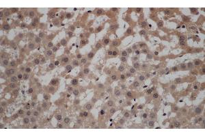 Immunohistochemistry of paraffin-embedded Rat liver using CALCRL Polyclonal Antibody at dilution of 1:50 (CALCRL antibody)
