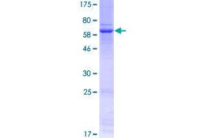 Image no. 1 for Wingless-Type MMTV Integration Site Family, Member 3 (WNT3) (AA 1-355) protein (GST tag) (ABIN1325359) (WNT3 Protein (AA 1-355) (GST tag))