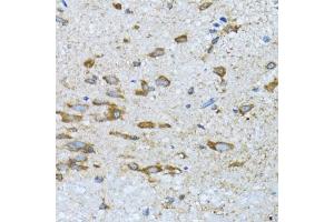 Immunohistochemistry (IHC) image for anti-Pyruvate Dehydrogenase Phosphatase (PDP) (AA 278-537) antibody (ABIN6145404)