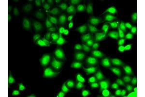 Immunofluorescence analysis of HeLa cells using GCK antibody. (GCK antibody)
