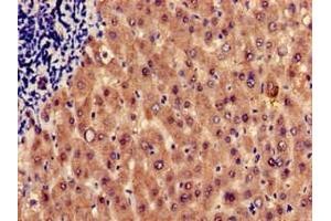 Immunohistochemistry of paraffin-embedded human liver tissue using ABIN7155233 at dilution of 1:100 (HRH1 antibody  (AA 211-416))