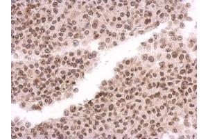 IHC-P Image Immunohistochemical analysis of paraffin-embedded HBL435 xenograft, using MAD1, antibody at 1:500 dilution. (PSMD14 antibody  (Center))