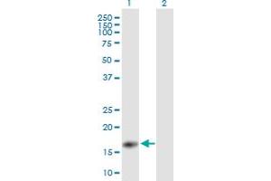 Western Blot analysis of PYCARD expression in transfected 293T cell line by PYCARD MaxPab polyclonal antibody. (PYCARD antibody  (AA 1-149))