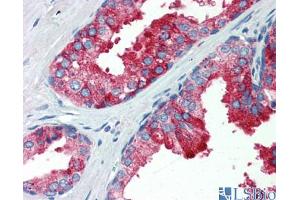 Immunohistochemistry (IHC) image for anti-Yes-Associated Protein 1 (YAP1) (C-Term) antibody (ABIN2784221)
