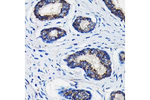 Immunohistochemistry (IHC) image for anti-alpha-Methylacyl-CoA Racemase (AMACR) (AA 1-198) antibody (ABIN3021498)