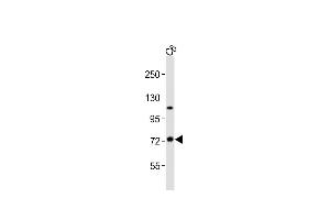 Anti-TAB2 Antibody (C-term)at 1:2000 dilution + C6 whole cell lysates Lysates/proteins at 20 μg per lane.