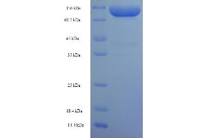 SDS-PAGE (SDS) image for Keratin 77 (KRT77) (AA 1-578), (full length) protein (His-SUMO Tag) (ABIN5711465) (Keratin 77 Protein (KRT77) (AA 1-578, full length) (His-SUMO Tag))