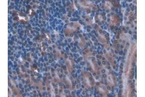 DAB staining on IHC-P; Samples: Mouse Kidney Tissue (TOR1AIP2 antibody  (AA 250-475))